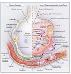 Acute Respiratory Failure Acute Lung Injury (ALI) Acute Respiratory Distres