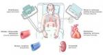 Acute Decompensated Heart Failure : étude de marché pharmaceutique